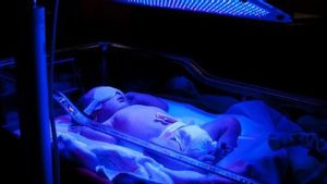 Efek Samping Fototerapi pada Bayi yang Perlu Diketahui