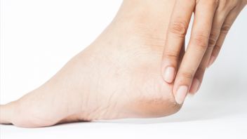 Overcoming Dry And Broken Feet Palms, Avoid Doing These 4 Things