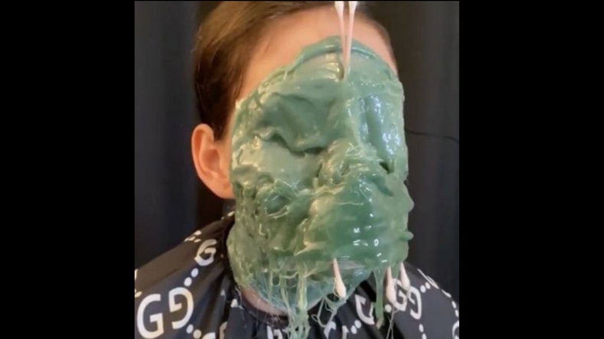 Many Health Experts Condemn TikTok's Viral Video Of Hot Wax Therapy For The Face