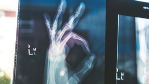 Klinik Pengobatan Radang Sendi Arthritis Terbaik