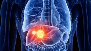 Heart Cancer Treatment Is Difficult And Expensive, Doctors Emphasize The Importance Of Hepatitis Vaccination B