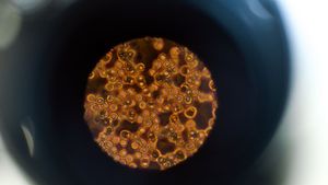 Types Of Immunity And How The System Works