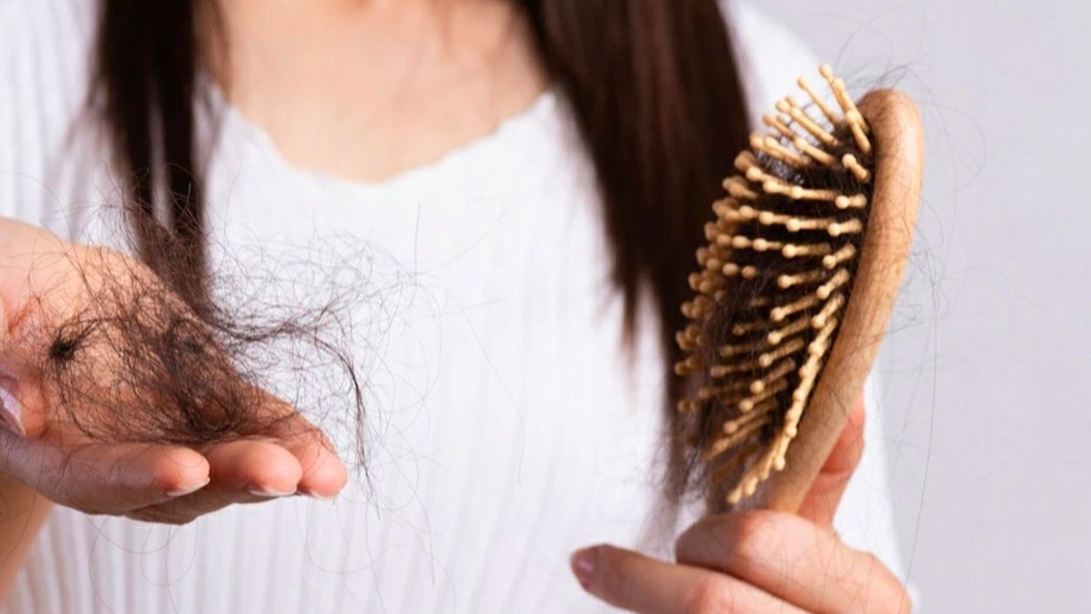 7 Symptoms Of Lack Of Iron That Are Rarely Aware Of, Hair Loss To Fatigue