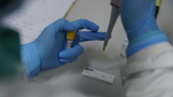 400 Mille Médicaments Antiviraux Paxlovides COVID-19 Est Arrivé En Indonésie