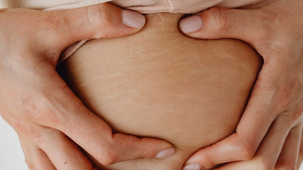 Know the Causes and How to Get Rid of Stretch Marks