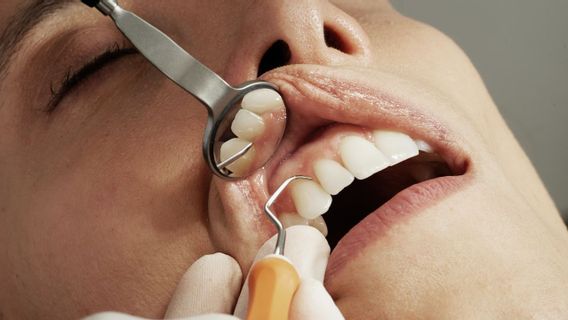 Comment surmonter les dents de goutte pour que les adultes se brisent rapidement, ce qui peut être fait à la maison