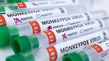 英国发现猴痘的新变种