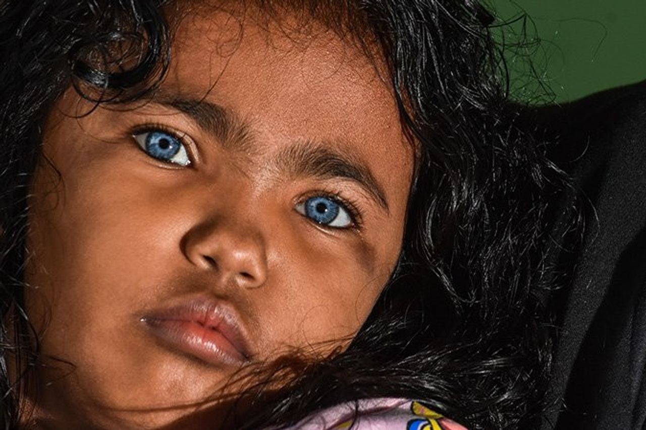 症候群 目 ワール デン ブルグ 青い “輝く青い目”を持つインドネシア「ブトン族」の人々が神秘的すぎる！ 一度見たら忘れられない「ワールデンブルグ症候群」の真実！