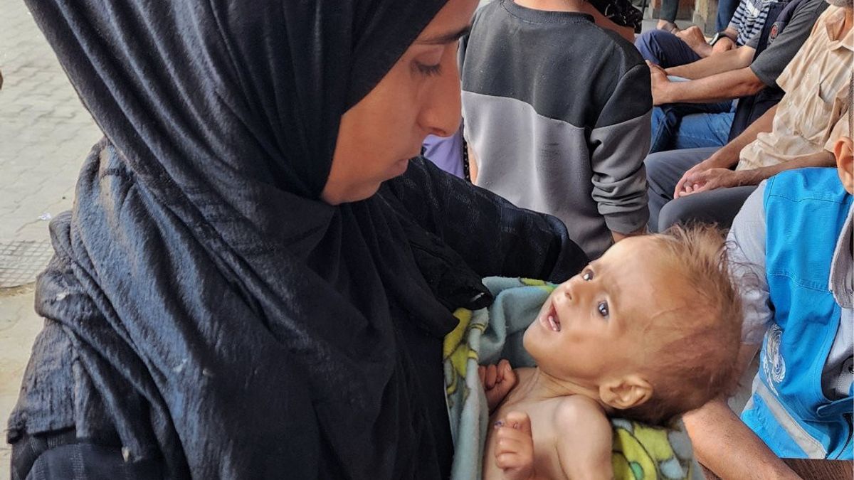 Anak-anak di Gaza Malnutrisi Akut Sejak Israel Kendalikan Penyaluran Bantuan Kemanusiaan 