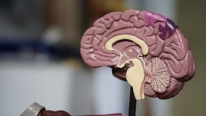 Tukul Arwana Alami Pendarahan di Otak, Kenali Tanda-Tandanya