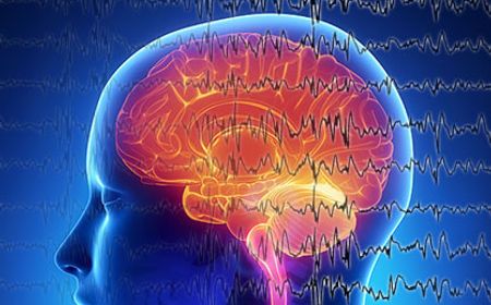 Penjelasan Stroke Hemoragik dari Gejala hingga Cara Mencegahnya