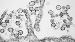WHOはオランダのクルーズ船で2番目のハンタウイルス症例を確認