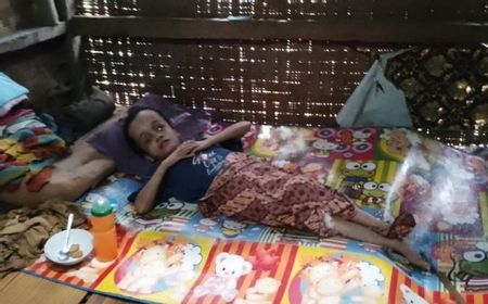 Gadis Penderita Hidrosefalus di Lebak, Banten Perlu Bantuan untuk Pengobatan