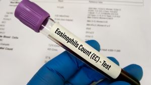 Penyebab Eosinofil Rendah, Gejala, Diagnosis, dan Cara Pengobatannya