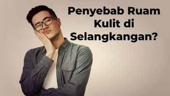 Ruam Kulit di Selangkangan sangat Mengganggu, Berikut Beberapa Penyebabnya