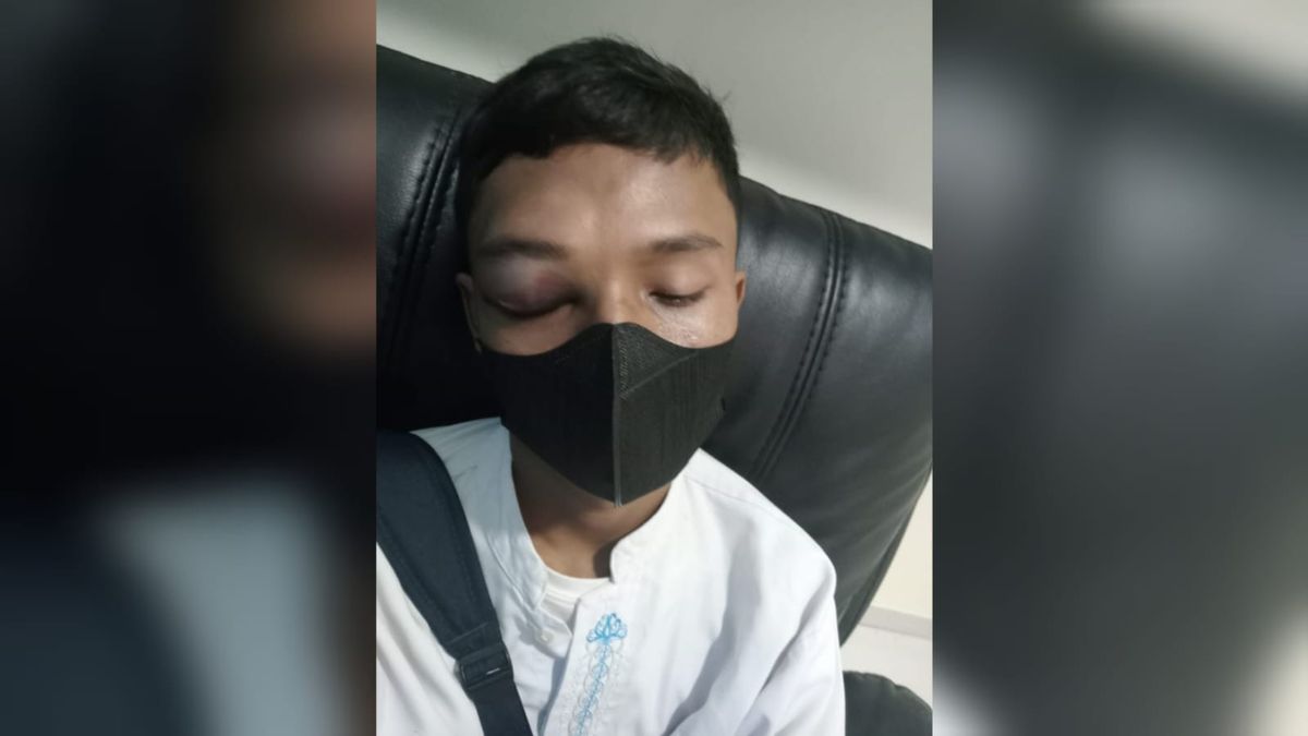 Oknum Guru SMKN 1 Jakpus Aniaya Anak Anggota TNI Karena Kesal Belakangan Sering Terjadi Pemalakan, Wakepsek: Tapi Caranya Salah