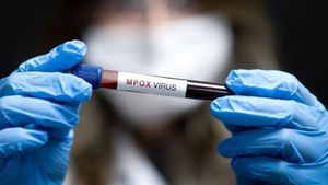 WHO Akhiri Status Darurat Mpox, Kasus Global Turun Signifikan
