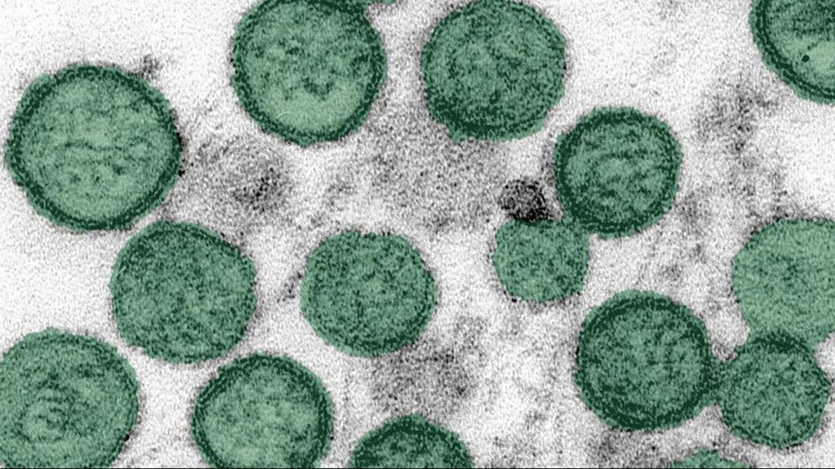 Biélorussie enregistre 50 cas de hantavirus chaque année