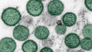 La France confirme le premier cas de hantavirus lié au MV du bateau de croisière Hondius