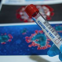 Update COVID-19 per 5 April: Kasus Baru 665, Kasus Aktif 5.945