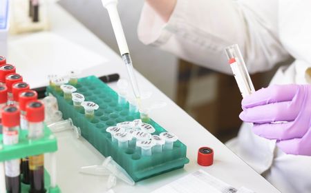 Bagaimana Cara Kerja Stem Cell dalam Mengatasi Penyakit? Simak Jawabannya di Sini