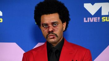 The Weeknd Attends MTV VMA 2020 With Bruised And Wound Face, What's Up?