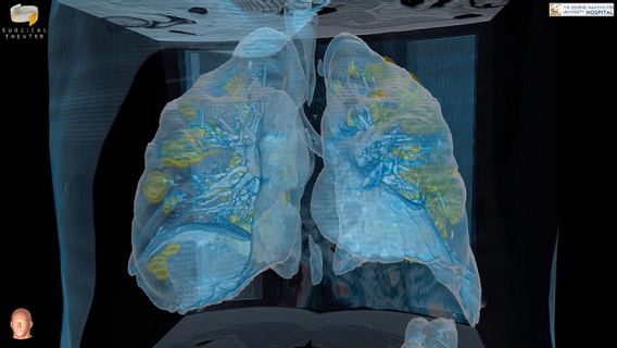 Virtual Projection Of Lung Conditions In COVID-19 Patients