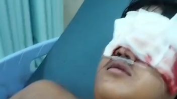 Breaking The Brawl Between Residents In Kampung Bahari Tanjung Priok, This Teenager's Finger Almost Broke