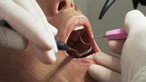 How To Get Rid Of Descent Dental Diseases So They Don't Get Relapsed