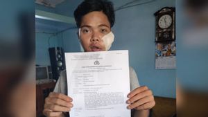 Begal Sadis di Kemayoran, Sabet Wajah Pria 20 Tahun Pakai Celurit Hingga Pipi Robek