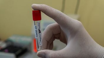 La Nouvelle Variante Du Coronavirus En France Peut-elle Se Cacher Du Test PCR, Est-elle Plus Mortelle Ou Contagieuse ?