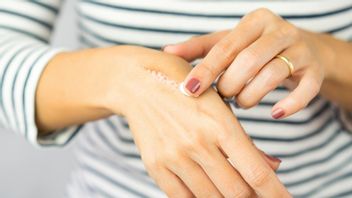 8方法自然で安全に色あせた傷跡を取り除く