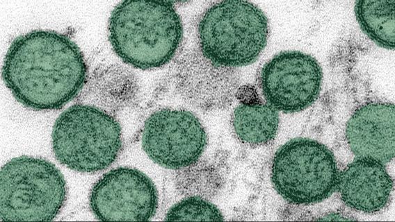Belarus Records 50 Hantavirus Cases Each Year