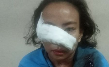 Janda Dua Anak Sayat Wajah Istri Mantan Pacarnya karena Kesal Sering Pinjam Uang dan Ingkar Janji Mau Dinikahkan