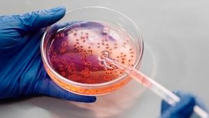 Kasus Infeksinya Meningkat di Amerika Serikat, Apa Itu Nightmare Bacteria?