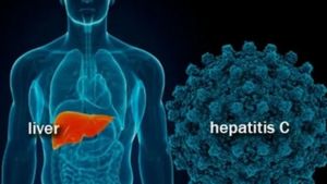 Ini Fase Penyakit Hepatitis Akut Berat Menurut Dokter Spesialis