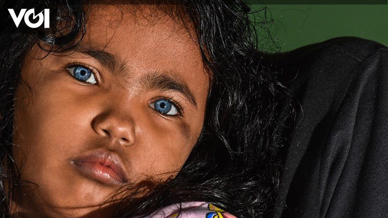 The Phenomenon Of Zizy, A Blue-eyed Child Like A European In Pekanbaru