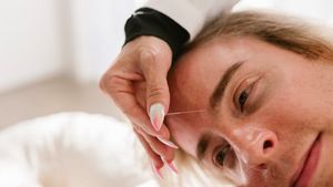 Tren Akupunktur Wajah Jadi Alternatif Filler, Ini Kata Dokter
