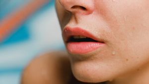 Penyebab Bau Mulut Tak Sedap, Apa Saja?