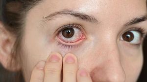 6 Kondisi Mata yang Menandai Kesehatan Tubuh Terganggu