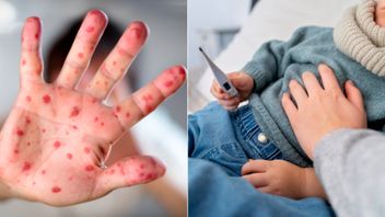 Les cas de HMFD chez les enfants continuent d’augmenter, la vaccination peut être une solution?