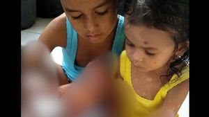 Video 2 Bocah Medan Penuh Luka Berdoa Viral, Ibunda Mohon Gubsu Edy Membantu