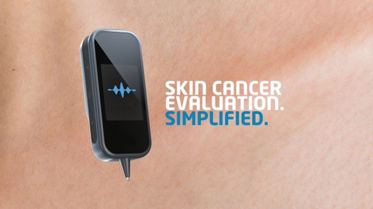 皮膚がん検査は、AIがん検出装置で直接行うことができるようになりました