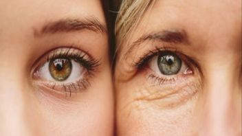 3 주름을 예방하는 영양 및 얻는 방법