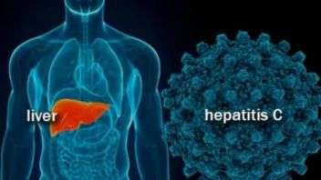発熱と吐き気最も一般的に見つかった神秘的な肝炎の症状