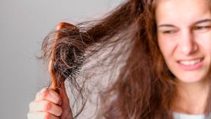 Waspada Rambut Rontok saat Diet, Bisa Jadi Tanda Tubuh Kekurangan Nutrisi