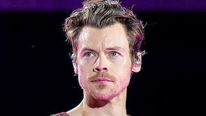 Harry Styles Isyaratkan Pernah Transplantasi Rambut, Rumor Garis Rambut Kembali Ramai