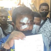 Polda Metro Limpahkan Berkas Perkara Kasus Pengeroyokan Haris Pertama