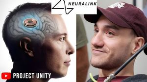 Neuralink's First Implant Patient: Extraordinary And Valuable Despite Technical Challenges