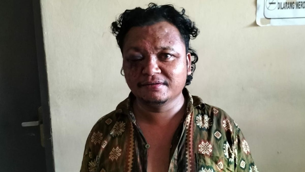 Danovan Sembiring Slapped The Police With His Left Hand After Angry On The Street